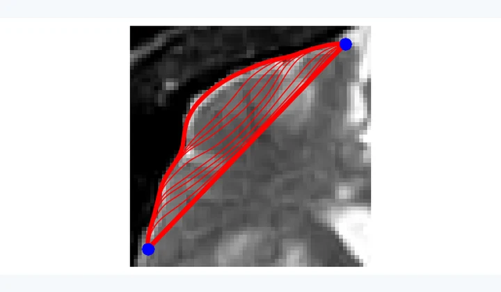 Computed results from Parametric Active Contours